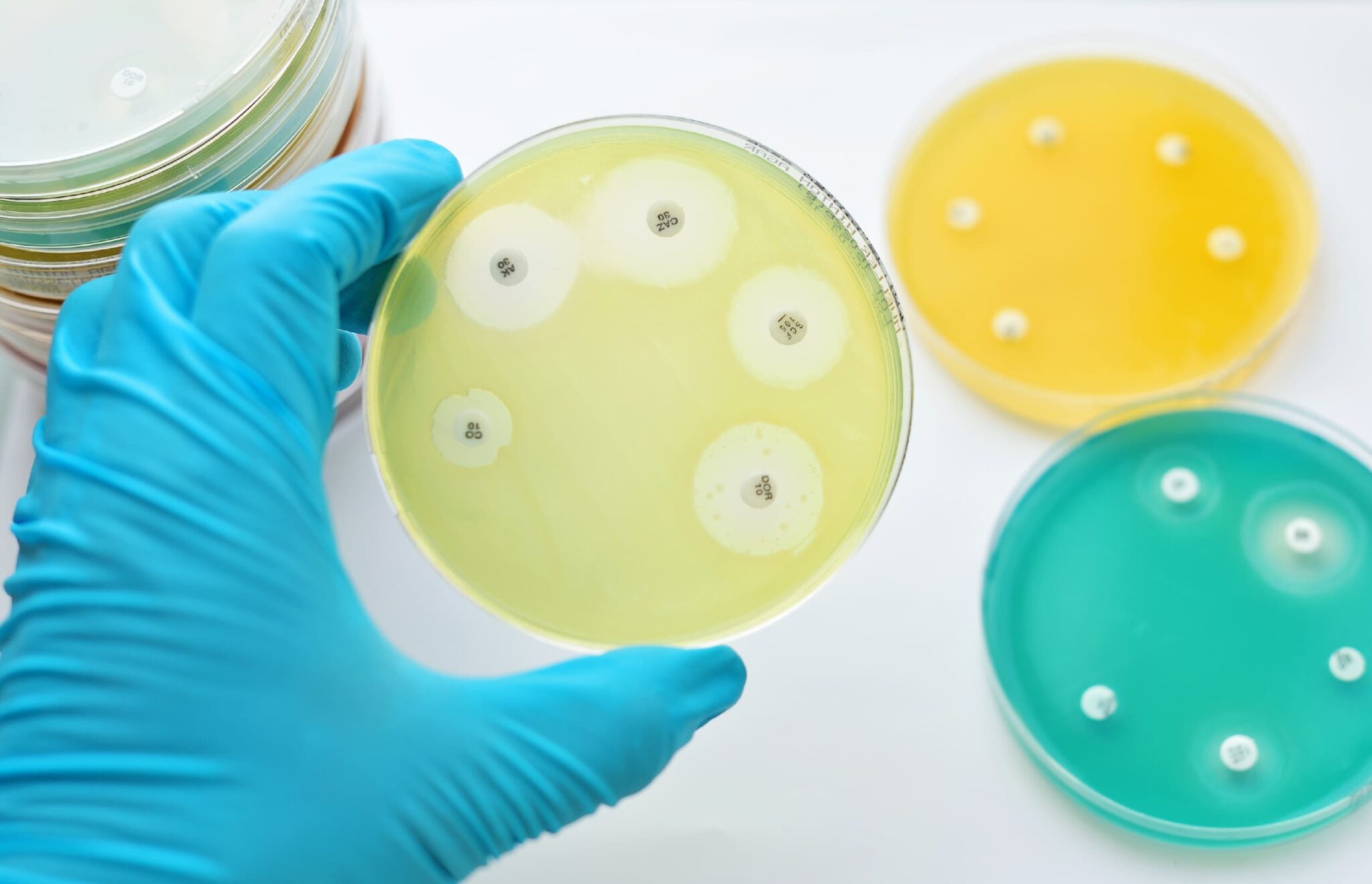 Antimicrobial Textile Testing: Methods, Standards & Compliance